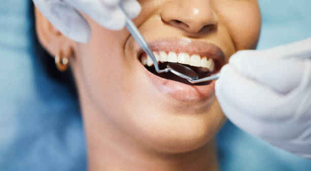 Best Emergency Dental Extractions in Mission Bend, TX