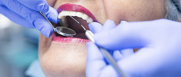 Best Broken or Cracked Tooth Emergency Dentist in Mission Bend, TX
